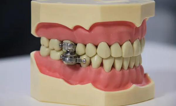 dentalslim